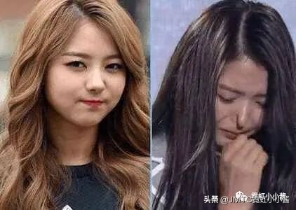 鼻子怎么修复好看呢,鼻型修复方法大全