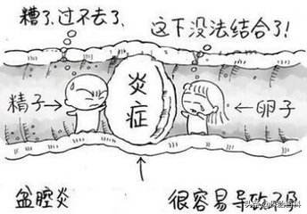 上班族,当心久坐让你的盆腔环境受“猝”卵巢排卵造人能力下降