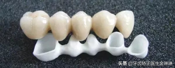 北京种后槽牙多少钱一颗,沈阳后槽牙种牙多少钱一颗