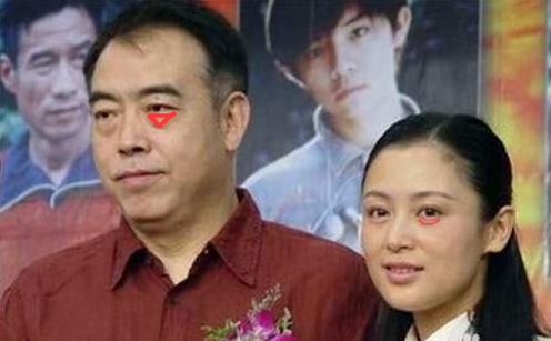 眼袋跟卧蚕的区别对比图,眼袋和卧蚕和黑眼圈的区别的图片