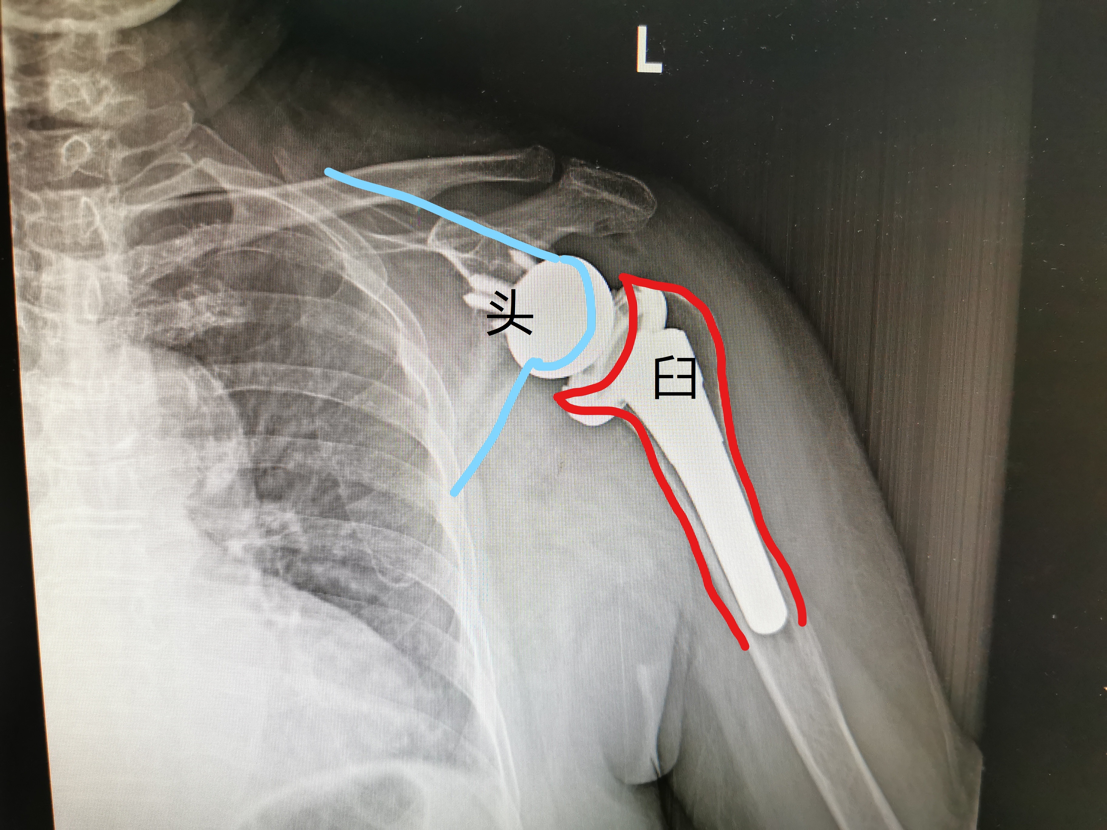中大骨科,中大医院骨科康复科