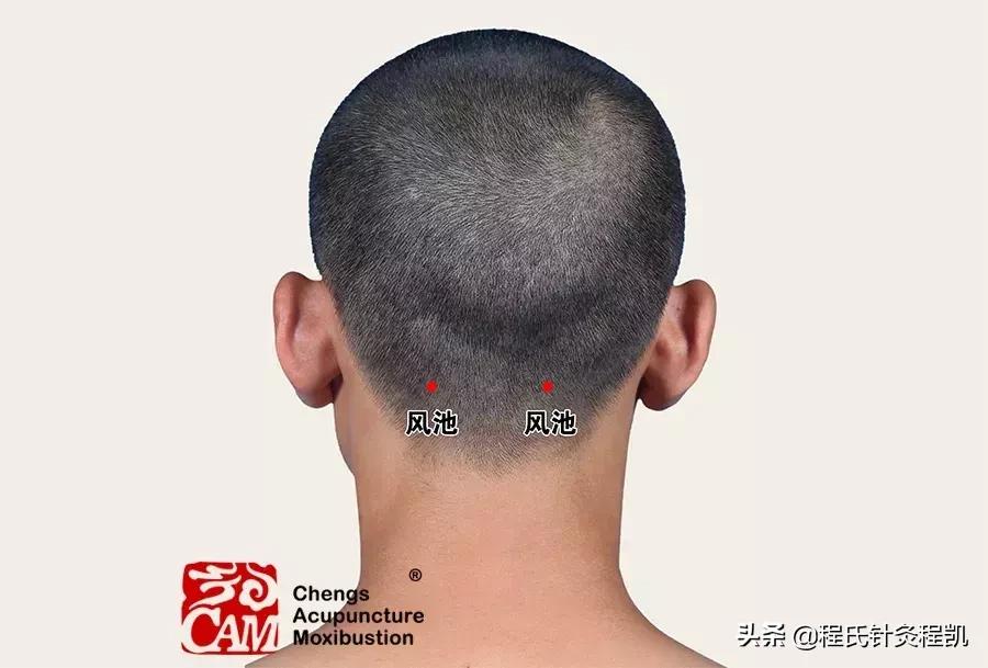 头痛厉害的一招解决方法,最严重的头痛有哪些