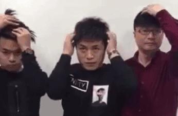 刮体毛会变好运吗,刮体毛导致体毛旺盛怎么办