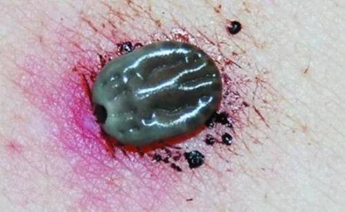 端午节怎么避毒,端午节需要注意的事项