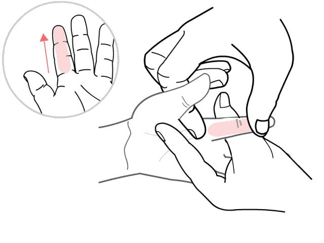 为什么孩子反反复复的咳嗽,为什么小孩咳嗽老是反反复复