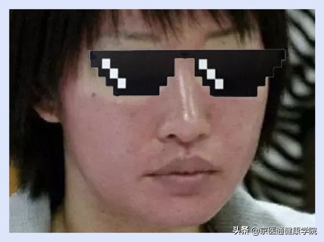 菲洛嘉一支能打全脸吗,菲洛嘉能维持一年吗