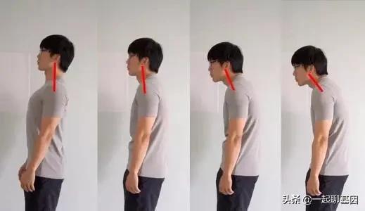 驼背怎么办最有效的方法,驼背怎么矫正最有效方法