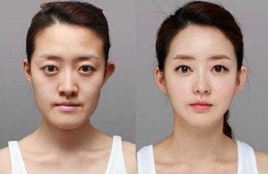韩国人皮肤为什么那么好那么细腻,韩国人皮肤超好的原因找到了