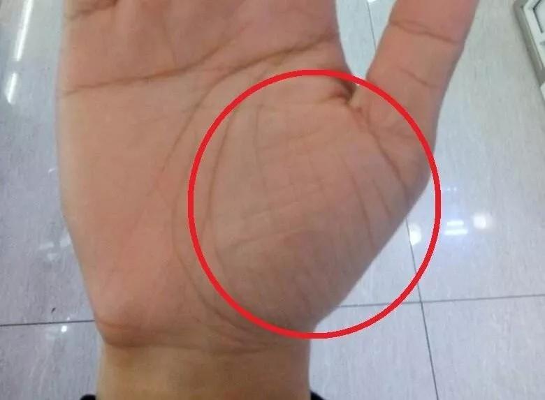 手健康有多重要,手型看健康