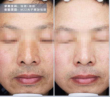 戚薇皮肤白到爆的秘诀,明星皮肤为什么这么好用