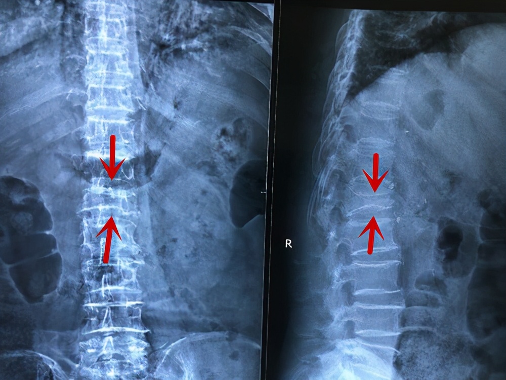 翻身疼深呼吸疼是怎么回事,向左翻身疼是怎么回事