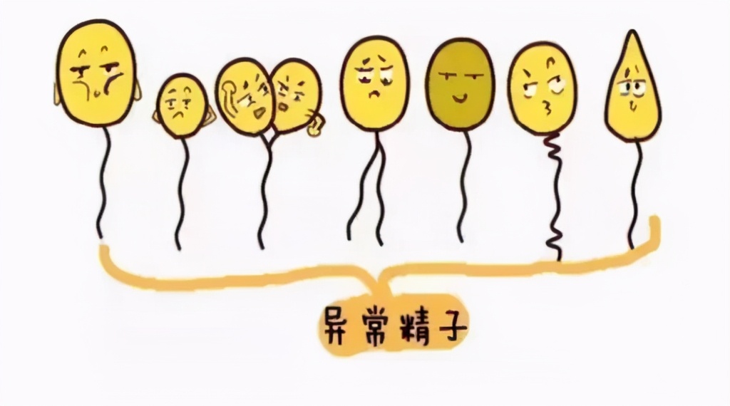 显微镜下x精子与y精子形态差别,精子碎片率跟精子形态成正比吗