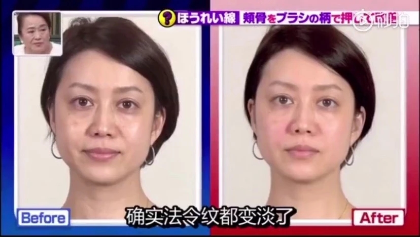 二十几岁法令纹特别明显是为什么,为什么比同龄人法令纹特别重