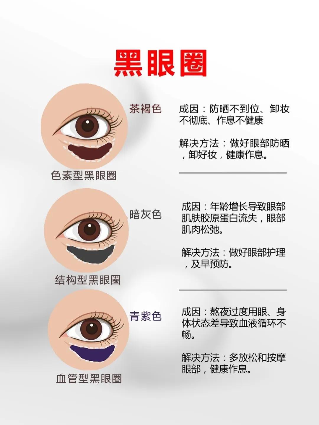 黑眼圈脂肪粒和细纹,一招解决眼袋黑眼圈眼角纹