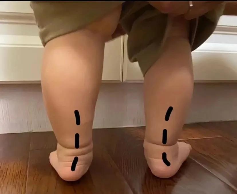 足弓塌陷的矫正动作懒人法,足弓改善动作