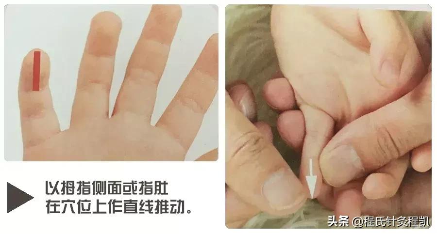 脾胃不和长期咳嗽的小儿推拿视频,小儿推拿流鼻涕咳嗽推哪个穴位