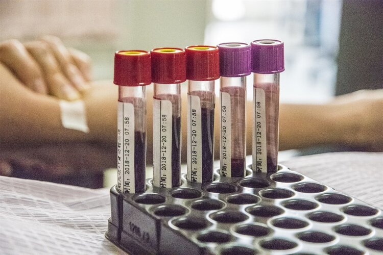 危害人类健康的病毒和病菌叫什么,艾滋病会引发肝癌吗