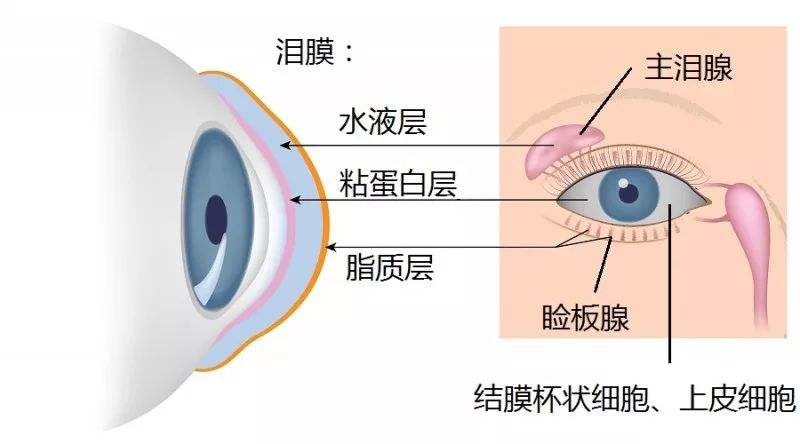 看电脑眼睛干涩模糊是什么情况,眼睛干涩畏光你要警惕干眼