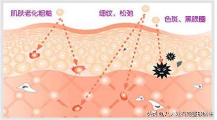 光子嫩肤会让皮肤变薄吗,长期光子嫩肤皮肤会变薄吗