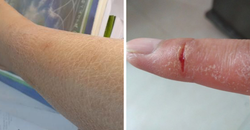 海豹油皮肤,海豹油外用美白效果怎么样