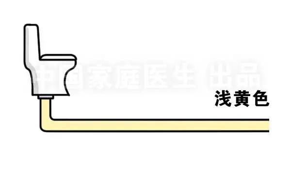 肝肾出现问题所表现的综合征,上厕所有四个症状说明肝有问题