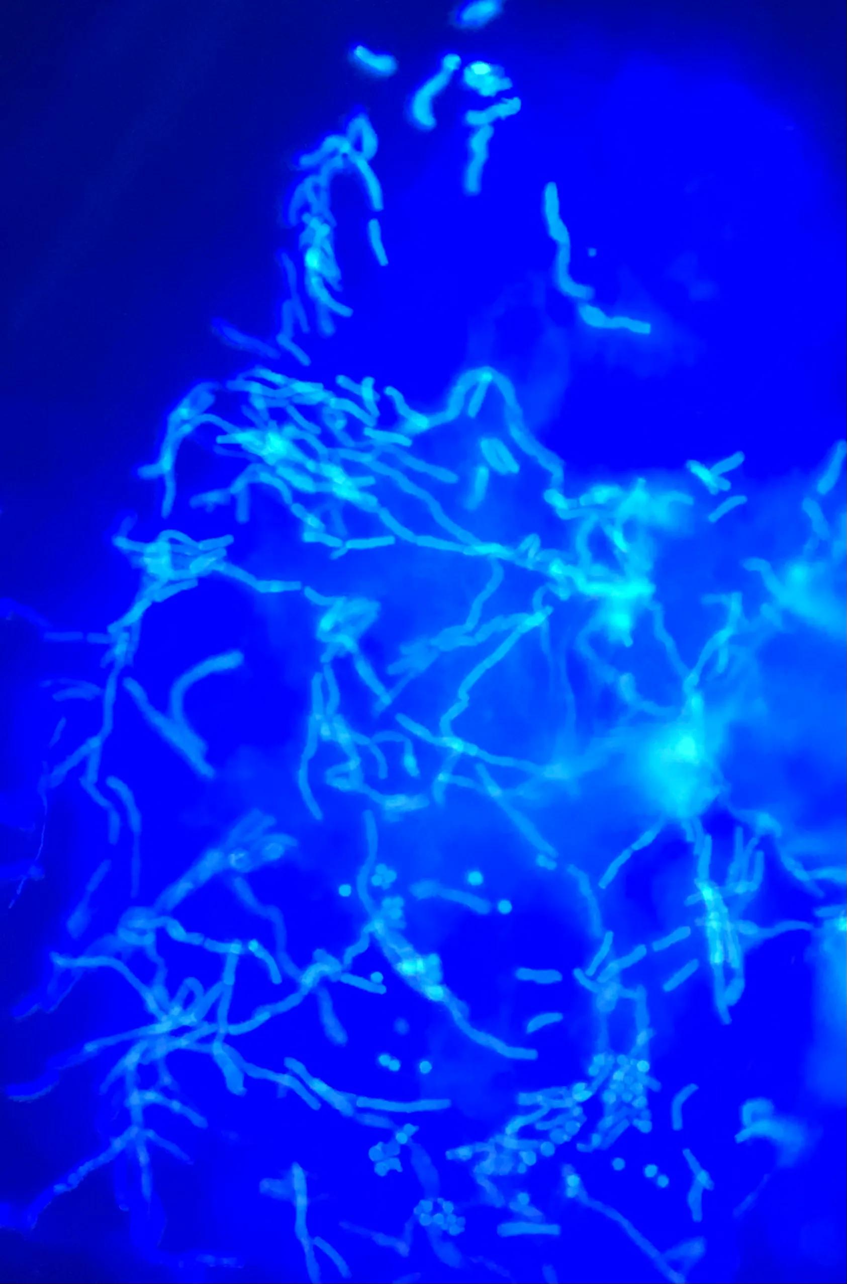 脚气怎么治专家现场演示,如何治脚气和脚汗