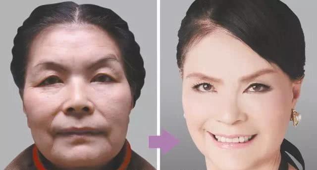 中国整容和韩国整容对比,比韩国更厉害的整容术