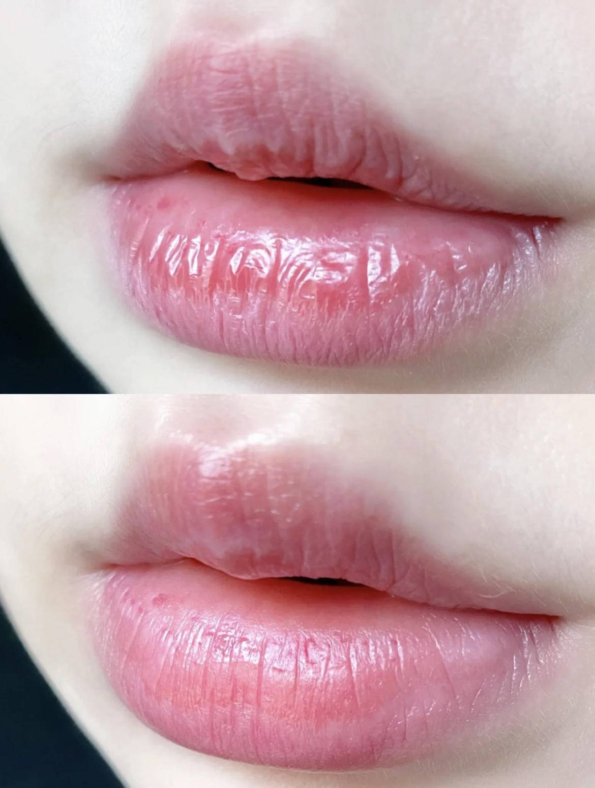 嘴唇水嘟嘟的太可爱了，但你的怎么还那么干瘪