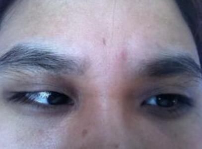 喜好咖啡的朋友注意！头一次听说“咖啡毁眼”？这是真的吗？