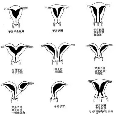 总是怀不上孕是为什么,总是怀不上二胎是什么原因