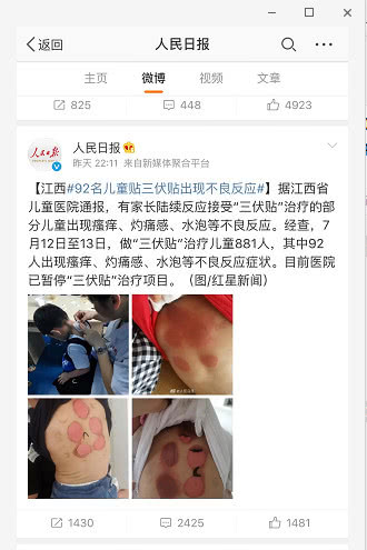 儿童贴三伏贴有用吗有什么不适,三伏贴什么天气贴比较好