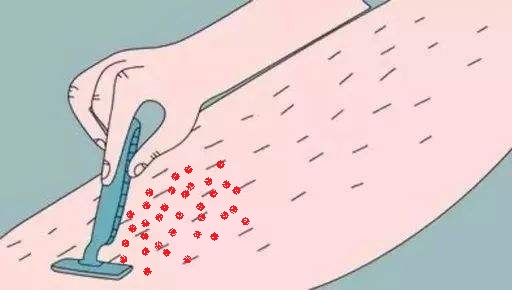 手术除去毛发叫什么,手术前怎么剃体毛