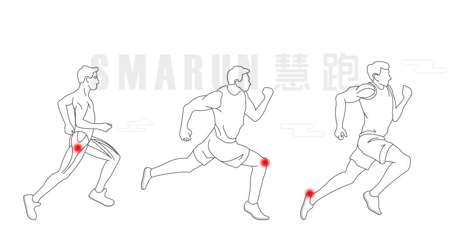 跑步足底痛的防治,足底跑步疼是什么症状