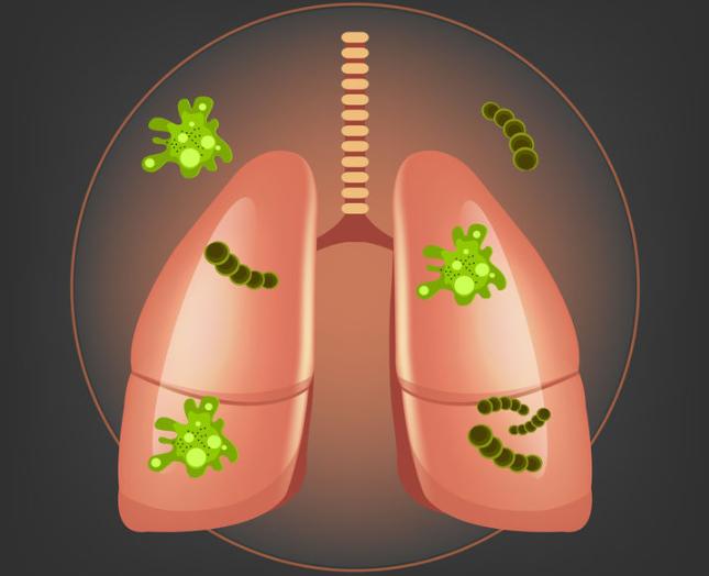 为何确诊肺炎，但白细胞却并不高？赶紧来了解一下