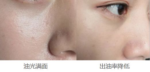 别再乱用清洁面膜了,如何正确洗脸既能白还能长痘