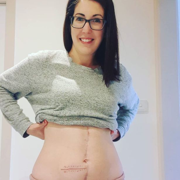 分娩方式很重要，这位墨尔本妈妈害怕自然分娩，剖腹产感染败血症