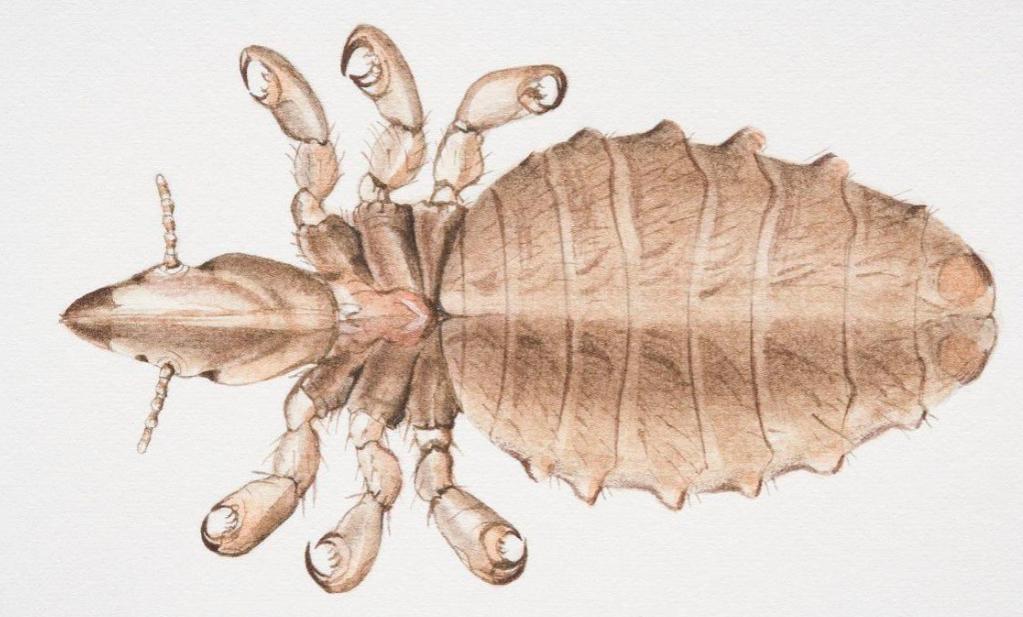 30年前每个人身上都有虱子,30年前人人都有的虱子为什么不见