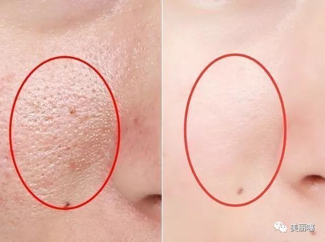 兰蔻粉水屈臣氏,屈臣氏38元兰蔻粉水