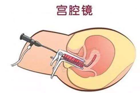 身体下部大量出血是怎么回事,下体出血不止1个月了怎么办