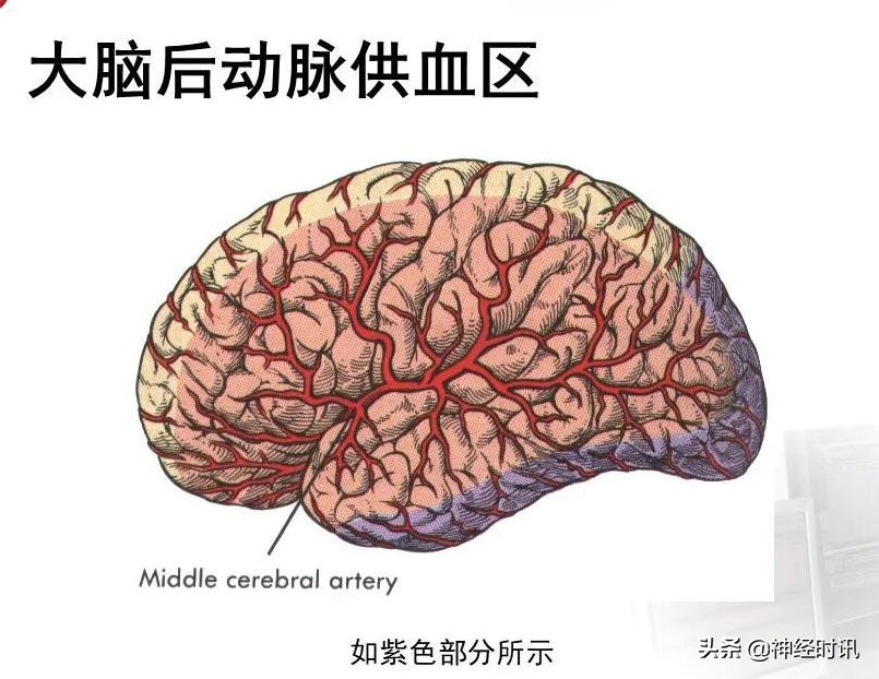 脑动脉解剖学讲解,基底节区脑血管解剖