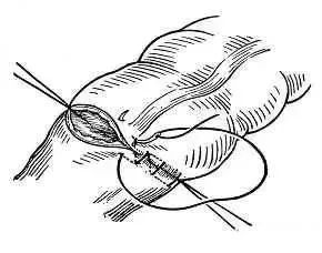 外科缝合方法笔记,兽医外科手术中最常用的缝合方法