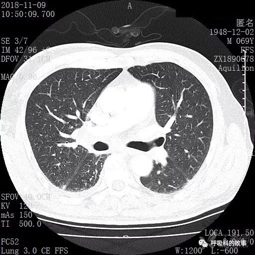 怎么应用统计学做调查,统计学方法可以解决的主要问题