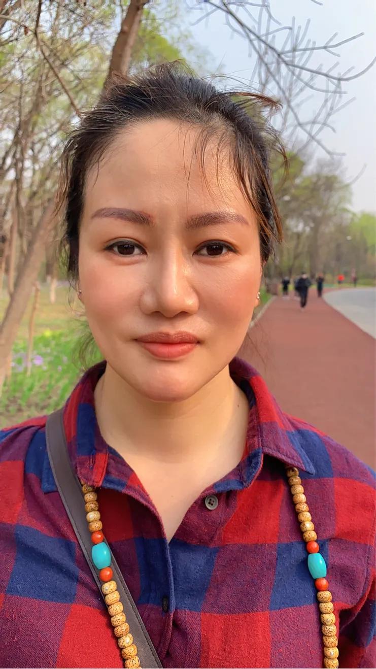 皮肤衰老了，长了印第安纹怎么办？