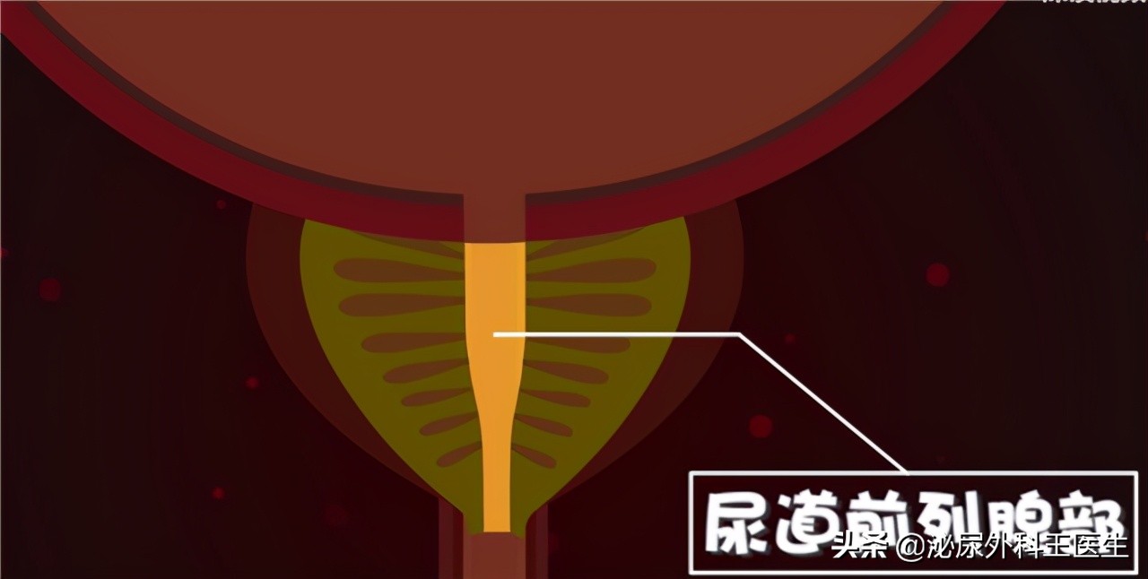 吃治疗前列腺炎的药反而更加尿频,吃前列腺增生药的副作用