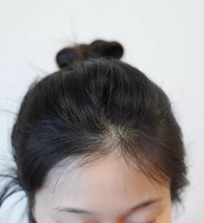 修饰扁头头型的发型,头型不好扁头适合什么发型