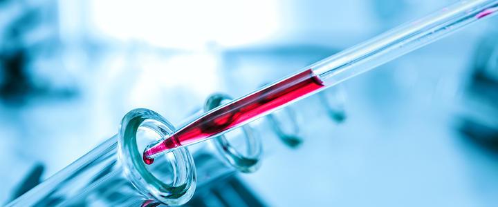 抗精子抗体asa阳性好不好治,抗精子抗体阳性是免疫性不育吗