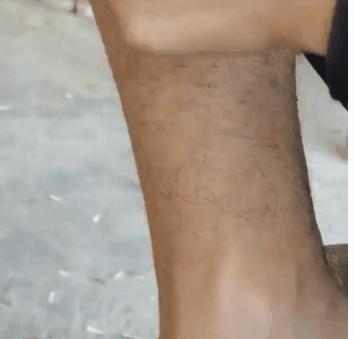 女生第一次脱毛应该怎么做,女生用的最多的脱毛方法