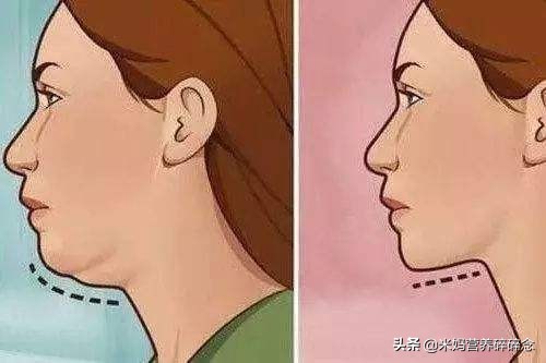 如何消除双下巴和两侧赘肉的方法,明明不胖为什么双下巴严重