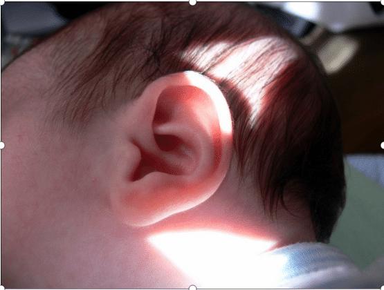 婴儿耳朵脏要处理吗,婴儿耳朵有耳垢怎么处理