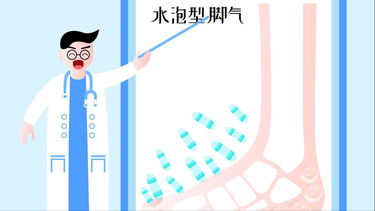 脚上痒痒的还有小疹子怎么回事,脚上手上起小水泡很痒怎么治疗